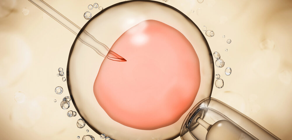 IVF insemination