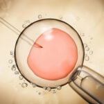 IVF insemination