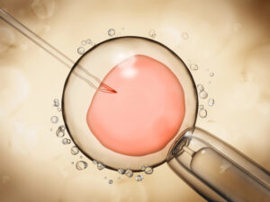 IVF insemination