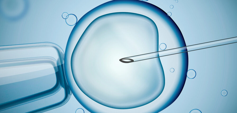 IVF procedure under microscope