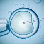 IVF procedure under microscope