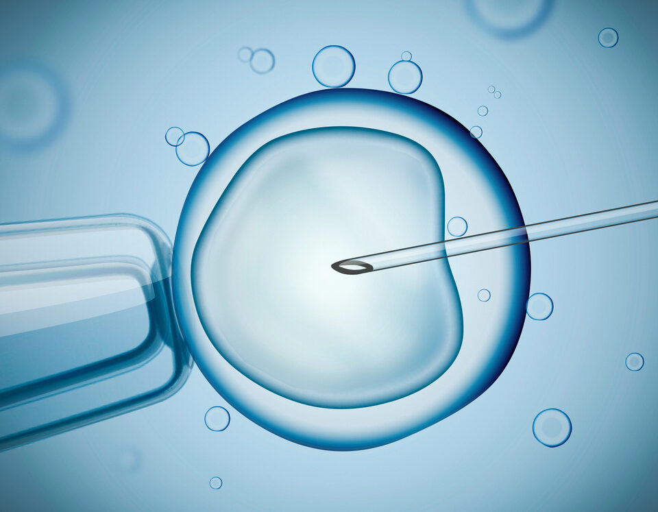 IVF procedure under microscope