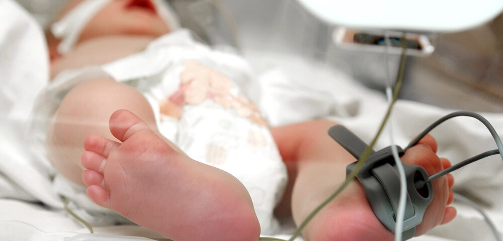 Baby in ICU