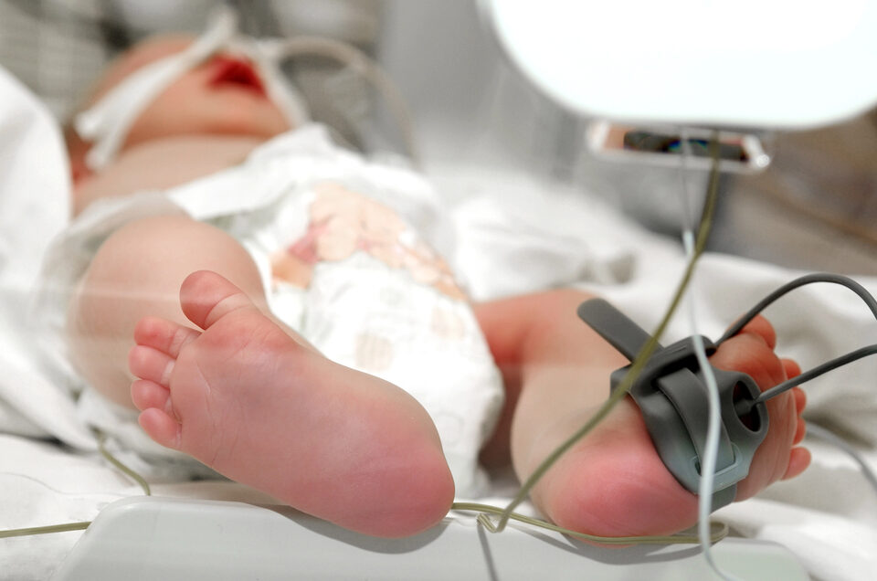 Baby in ICU